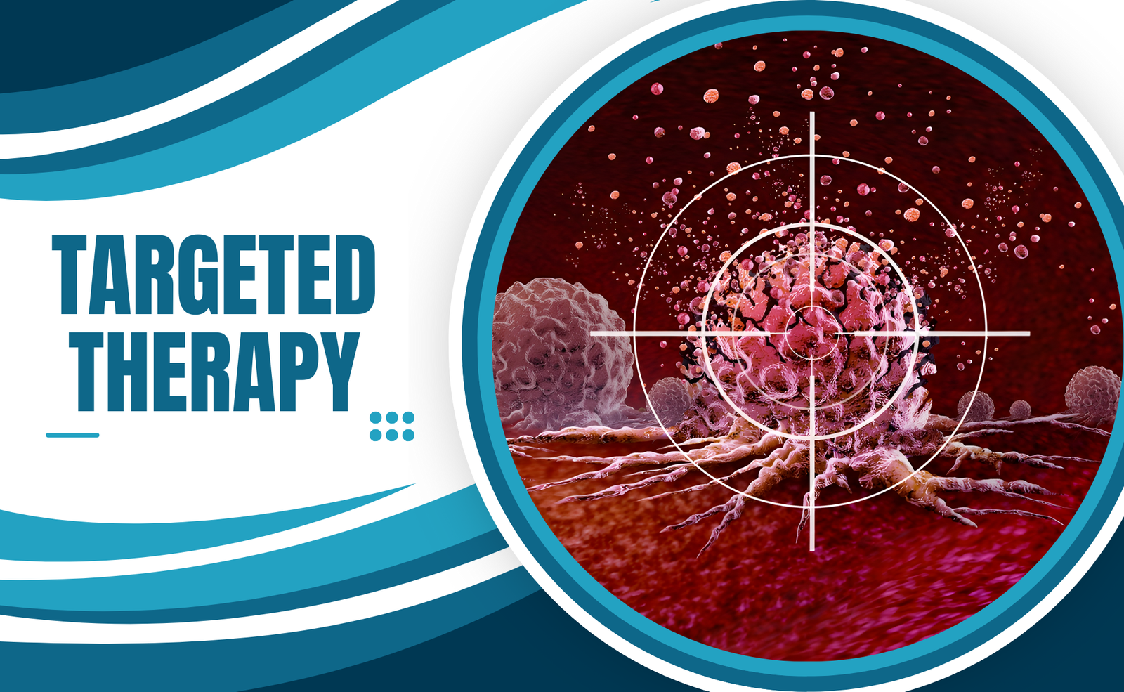 Targeted Therapy